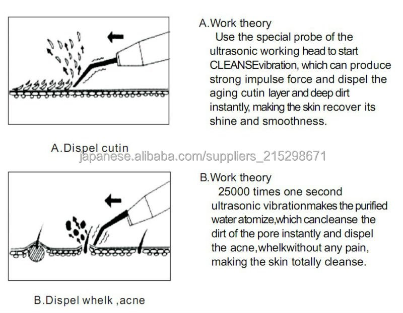 アクア毛穴クリーン 超音波美顔器 ソニック毛穴ピーラー問屋・仕入れ・卸・卸売り