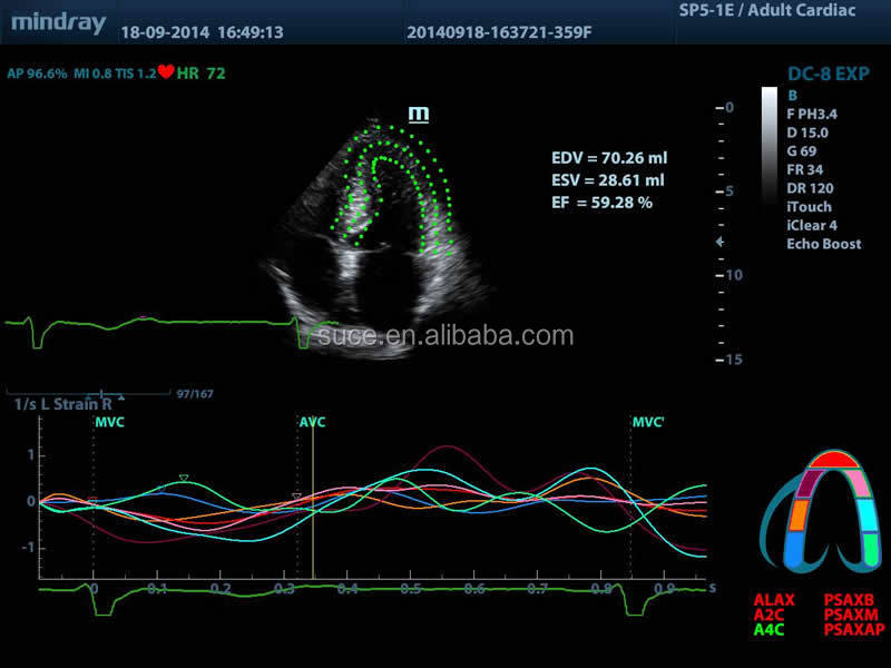 フルデジタルmindray高- グレードカラードップラー超音波診断機器仕入れ・メーカー・工場