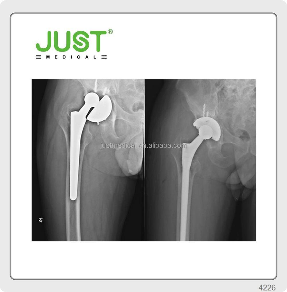 orthopedic prothesis company orthopedic prothesis company