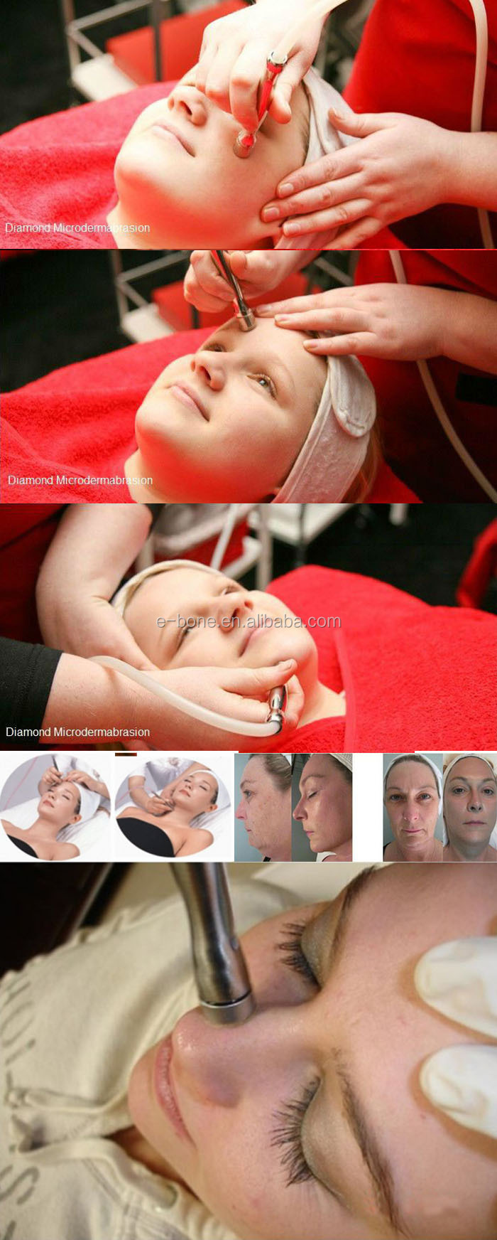 ダイヤモンドのmicrodermabrasion101で光子療法と寒さとホットハンマー問屋・仕入れ・卸・卸売り