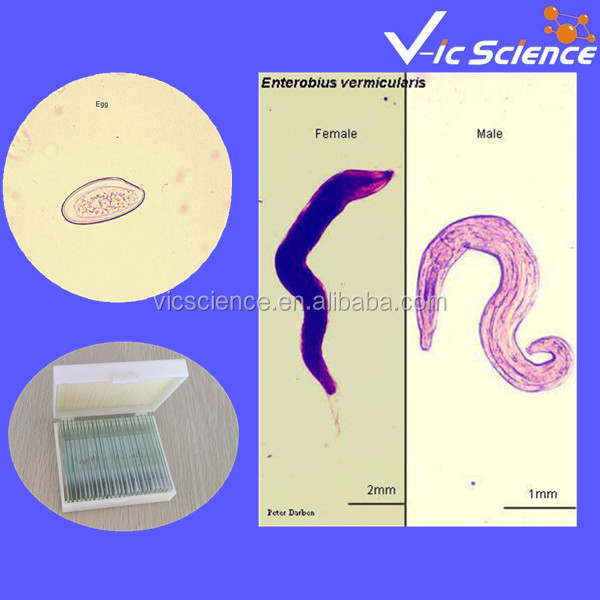 医療parasitology50個準備されたスライドセット問屋・仕入れ・卸・卸売り