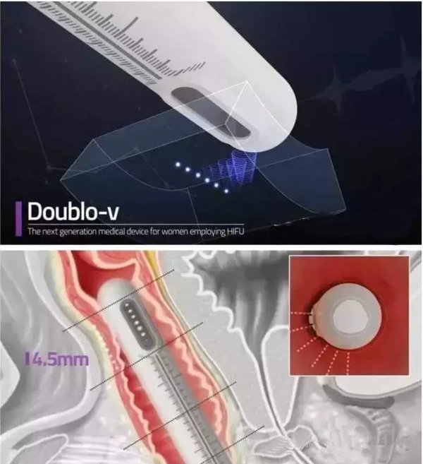 Portable HIFU Machine!!! Face TignteningVaginal Tightening HIFU Machine for Salon Use.png