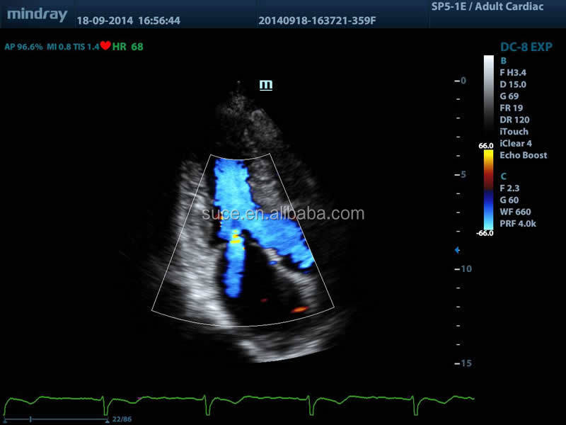 フルデジタルmindray高- グレードカラードップラー超音波診断機器仕入れ・メーカー・工場