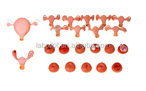 F30S uterus.jpg