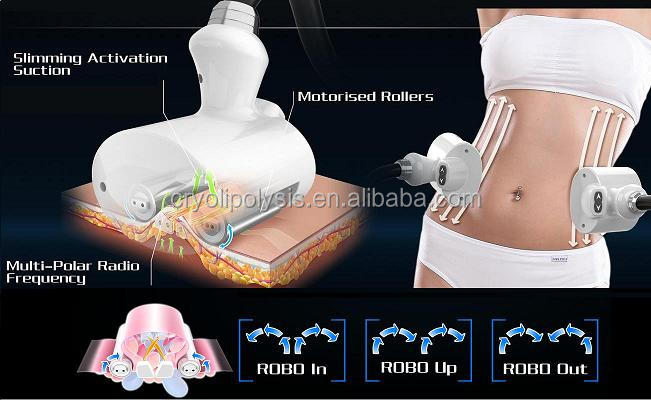Vacuum RF Rollers.JPG