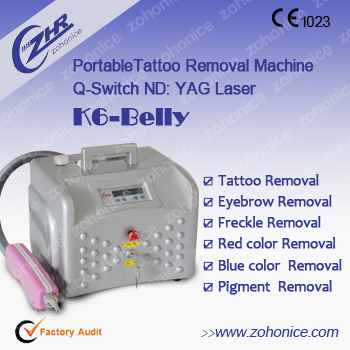 ... machine prices machine tattoo removal laser tattoo removal machine