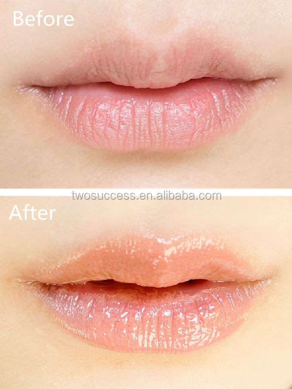 Lip Gloss (11)