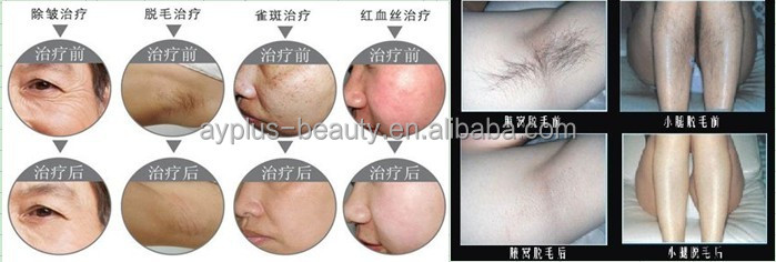 ポータブル美容サロンipl/eライトマシン脱毛iplマシン美容製品ayj- 308a( ce)問屋・仕入れ・卸・卸売り