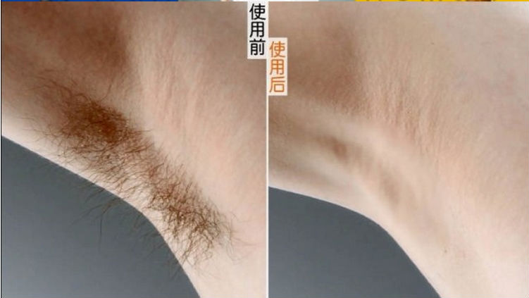 強力なオーセンティックのための永久脱毛g3012oem問屋・仕入れ・卸・卸売り