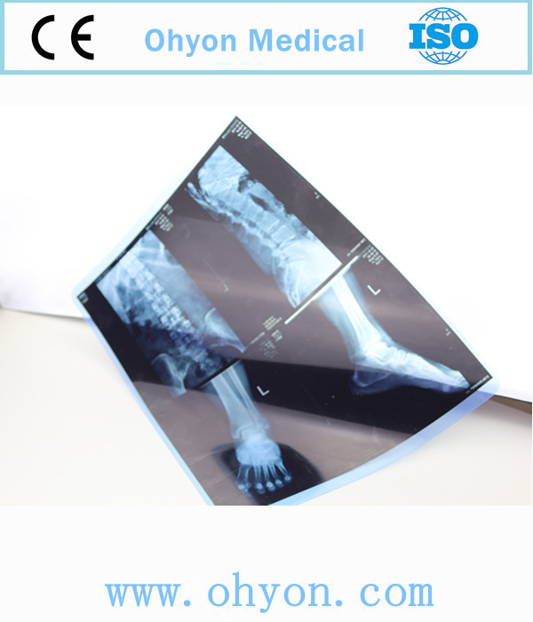 医学日本ドライレーザーのx線医療x線イメージングフィルムの価格仕入れ・メーカー・工場