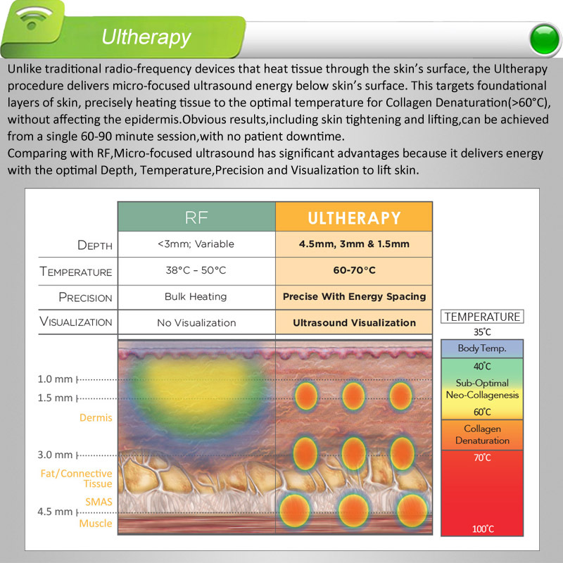 プロの2015ultherapyマシンの販売、 集束超音波hifu高強度、 33侵入深さのヒント必要な販売代理店問屋・仕入れ・卸・卸売り