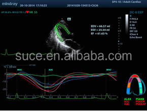 フルデジタルmindray高- グレードカラードップラー超音波診断機器仕入れ・メーカー・工場