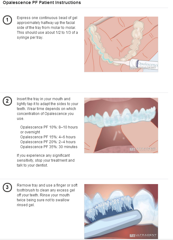 Best Sell Home Use Opalescence Tooth Whitening Gel Buy Tooth