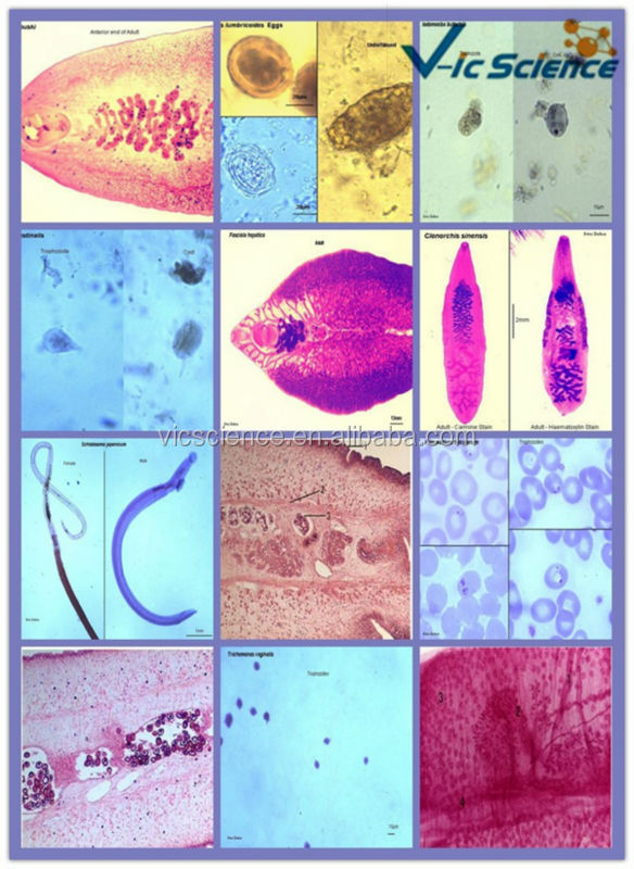 トップ販売の教育準備parasitologyスライドセット問屋・仕入れ・卸・卸売り