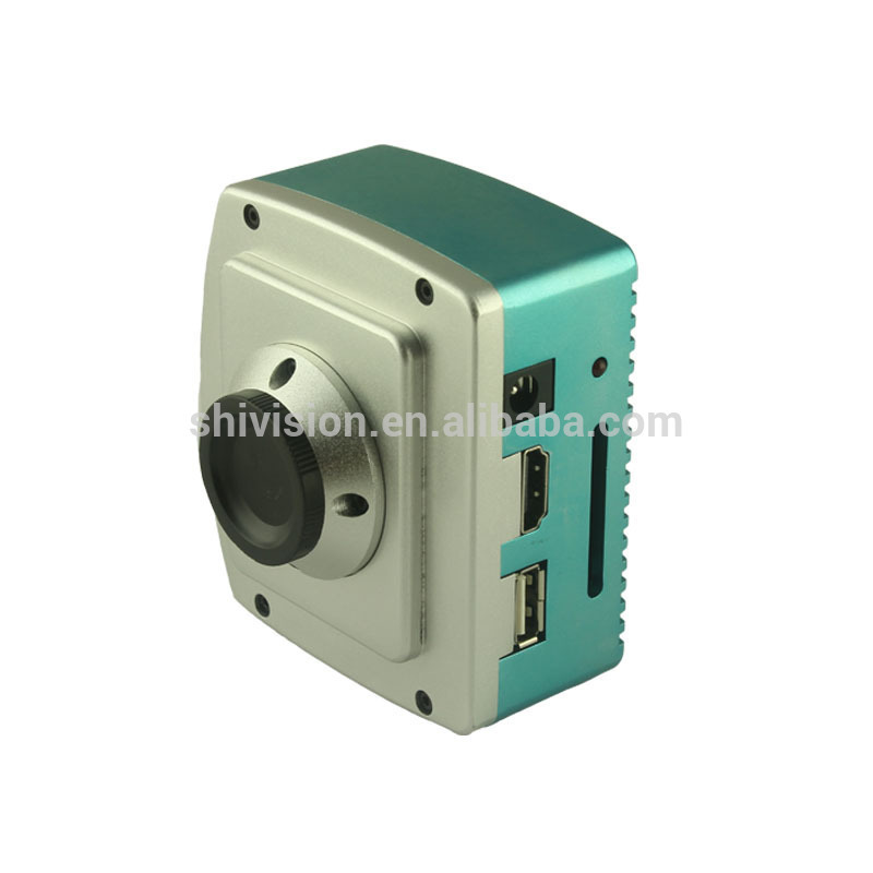 インチフルhd1/2.862.0顕微鏡用カメラメガピクセル医療を使用して仕入れ・メーカー・工場