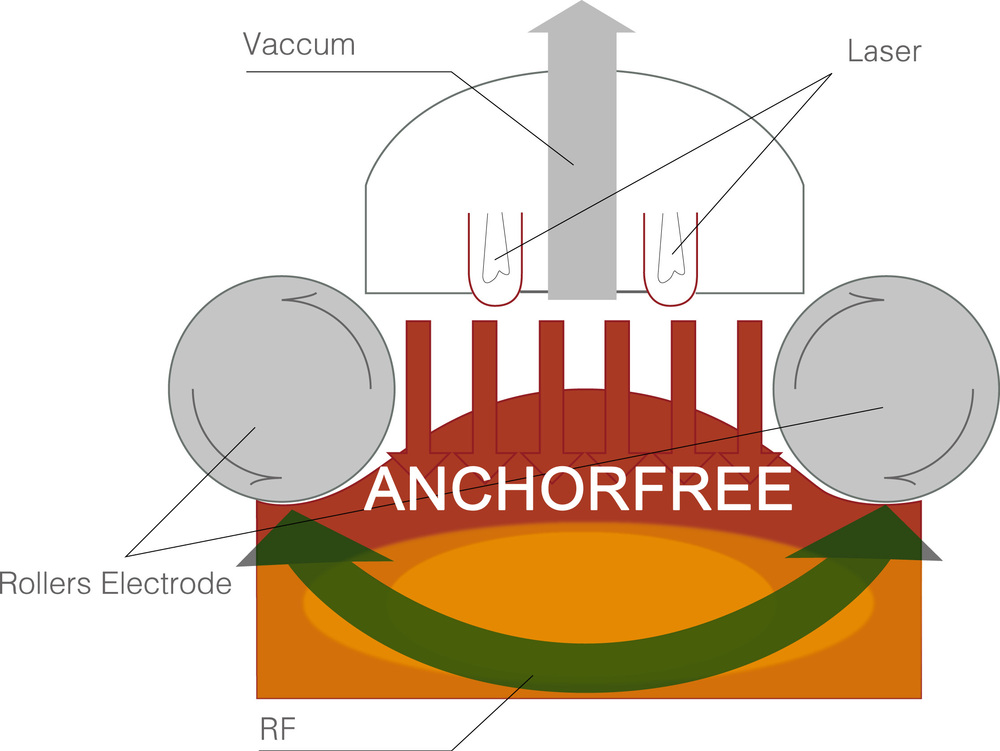 最高の減量anchorfree機( v8c1)問屋・仕入れ・卸・卸売り