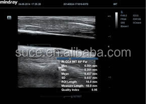 フルデジタルmindray高- グレードカラードップラー超音波診断機器仕入れ・メーカー・工場