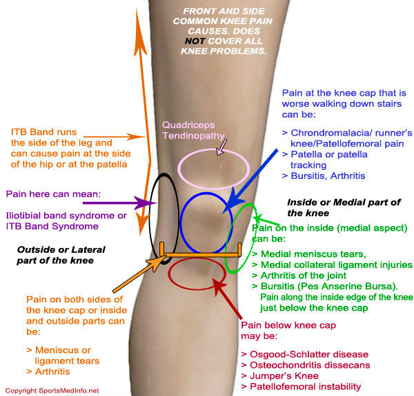 ネオプレンの膝ブレース整形外科非変形性関節症問屋・仕入れ・卸・卸売り