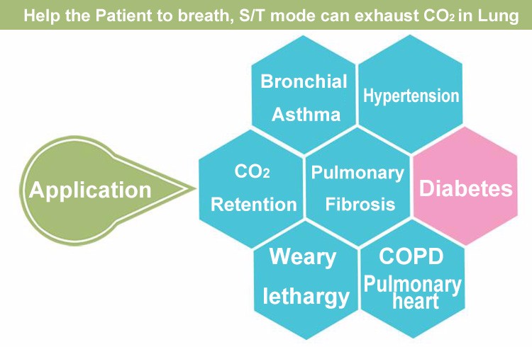 cpap detail