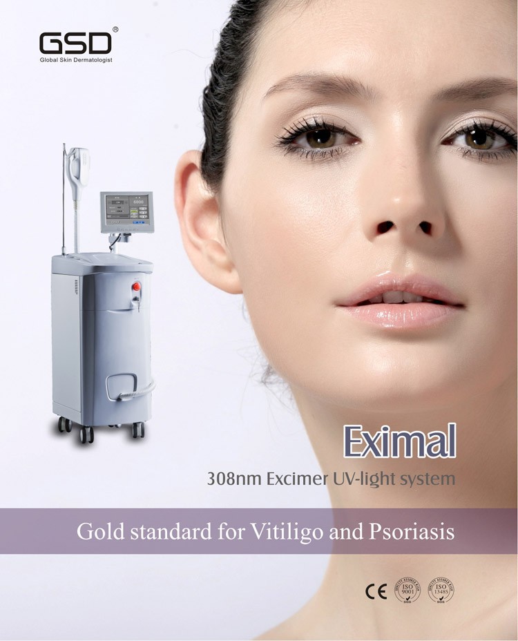 308XL <b>excimer laser</b> 308nm psoriasis vitiligo laser for vitiligo treatment ... - HTB1kMoTIFXXXXbDaXXXq6xXFXXXI