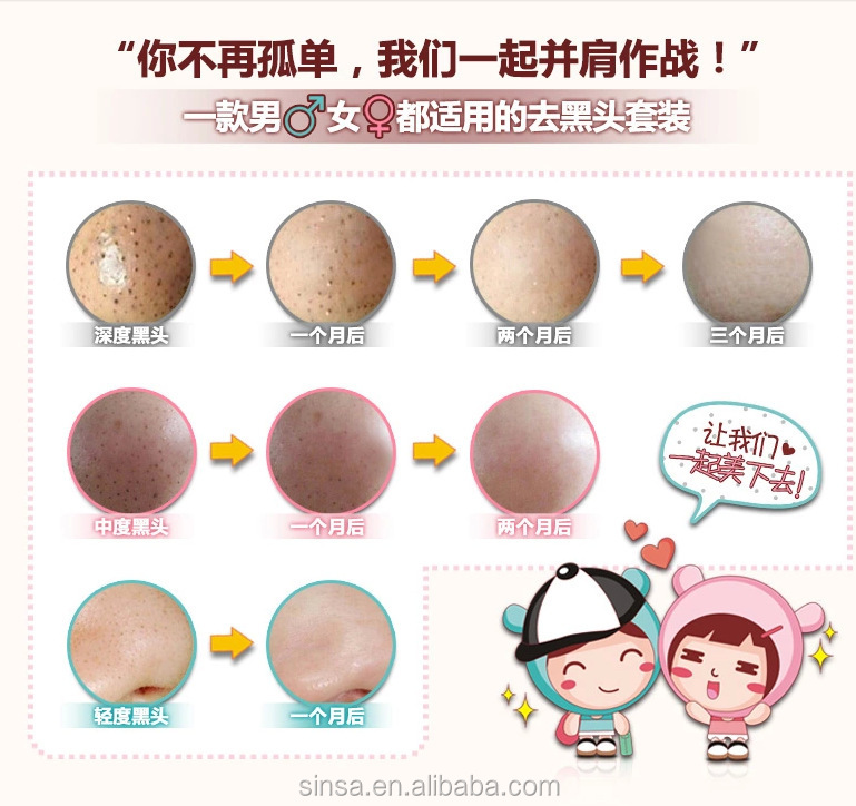 毛穴の黒ずみの細孔クレンジングニキビ肌のフェイスマスク 問屋・仕入れ・卸・卸売り