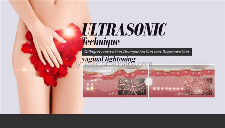 Vaginal Use Hifu...-..jpg