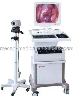 Mce- exrh- 220fデジタル電子の膣鏡膣検査のための機器仕入れ・メーカー・工場