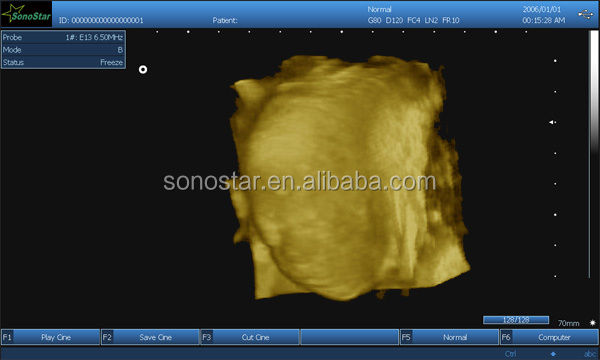 SS-9 PC ba<em></em>sed Laptop Ultrasound B scanner(ultrasound, ultrasoni, scanner)仕入れ・メーカー・工場