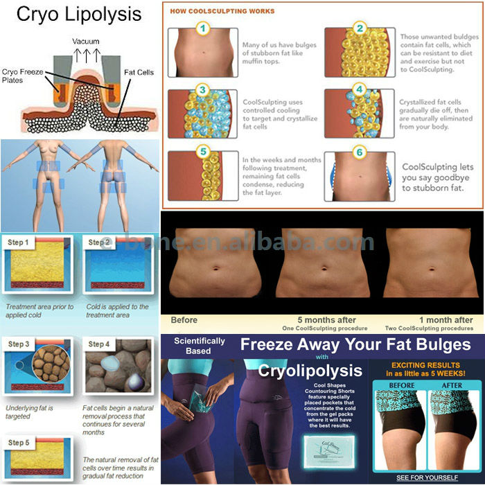 熱い販売のリポキャビテーションクライオ/キャビテーションcryolipolysis付縦型マシン問屋・仕入れ・卸・卸売り