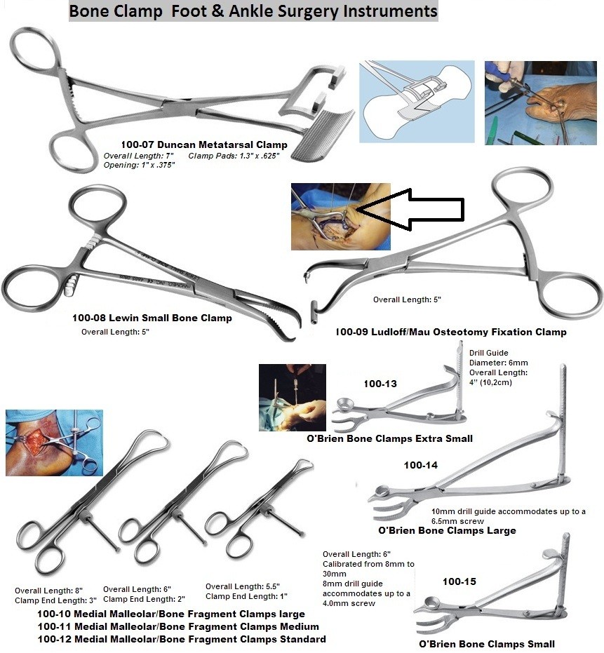 足と足首の手術Surgery of the foot and ankle 2冊